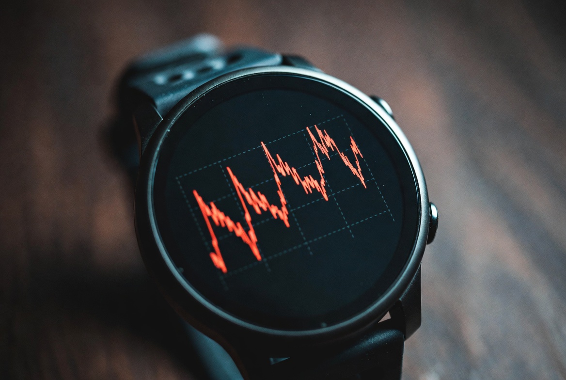 Heart rate monitor showing high intensity interval spikes
